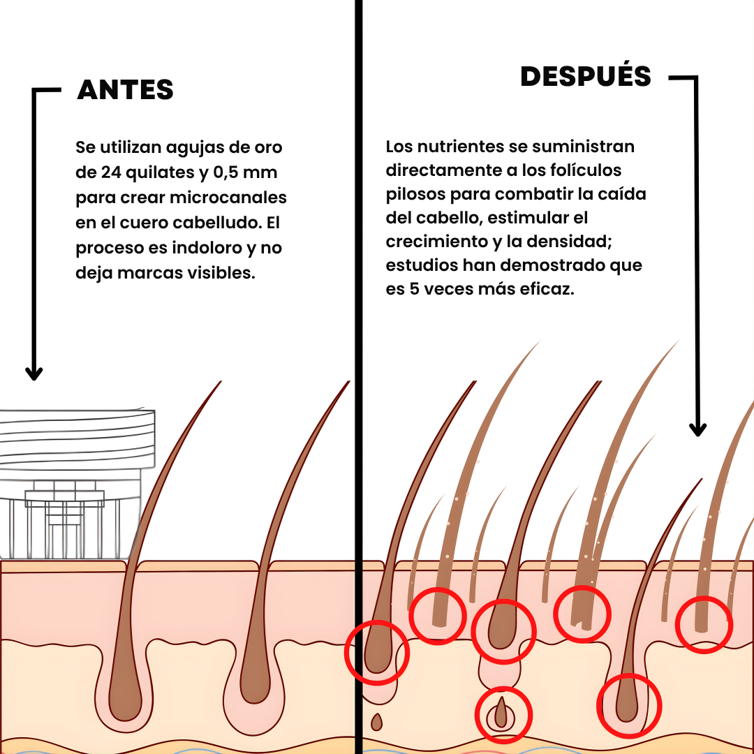 CapilumPro™ Sistema de Crecimiento Capilar