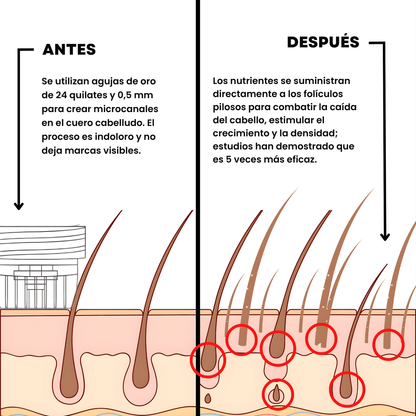 CapilumPro™ Sistema de Crecimiento Capilar